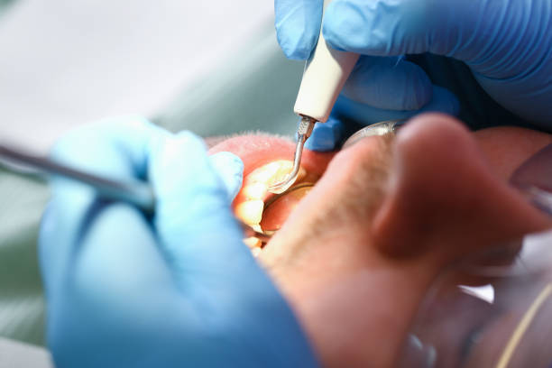 Fast & Reliable Emergency Dental Services in AR
