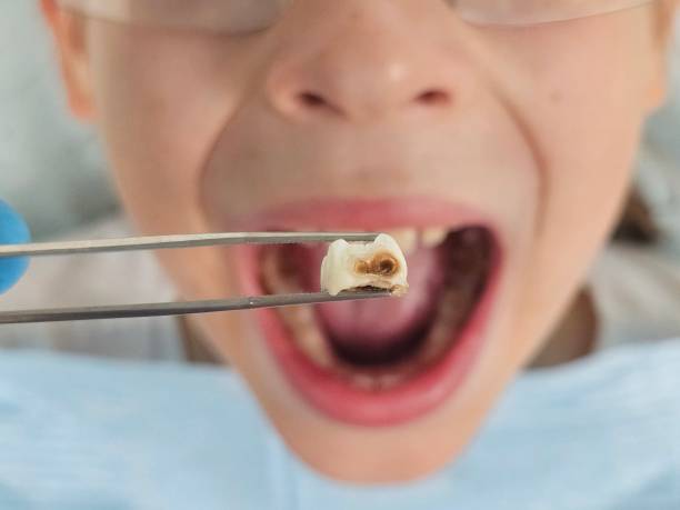 Best 24-Hour Emergency Dentist in Clendon, AR