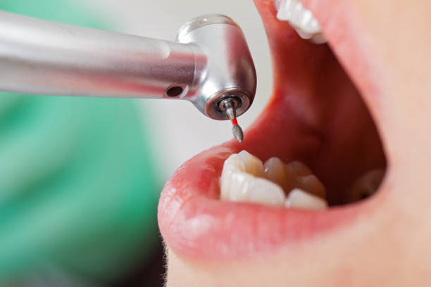 Best Emergency Dentist for Lost Fillings or Crowns in Clendon, AR